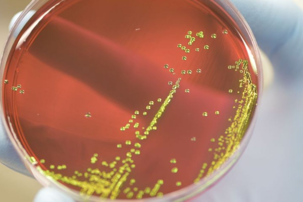 [Infecções por superbactérias levaram 1,2 milhão de pessoas à morte em 2019]