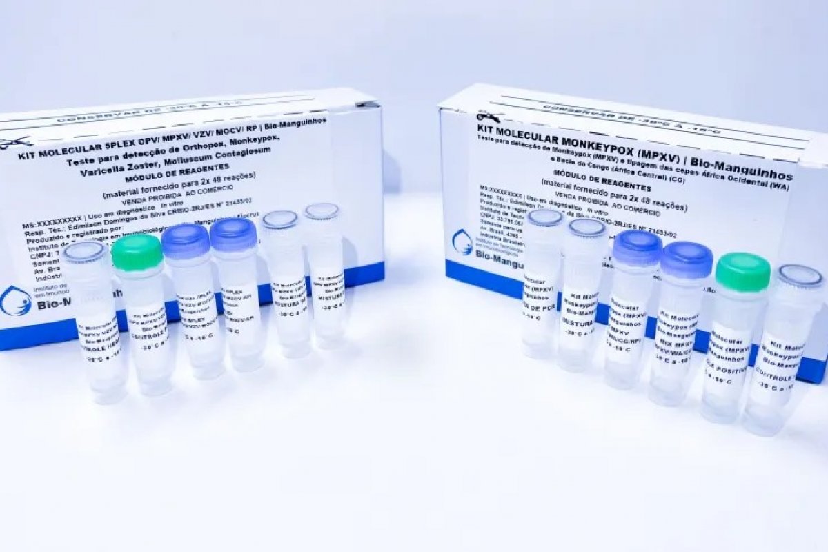[ Anvisa aprova registro de primeiro teste para diagnóstico da varíola dos macacos no Brasil]