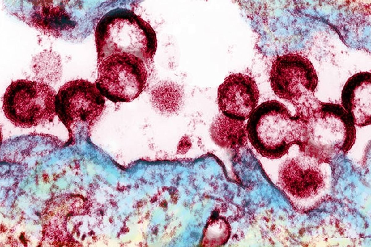 [Cientistas usarão nova técnica para eliminar HIV totalmente do corpo]