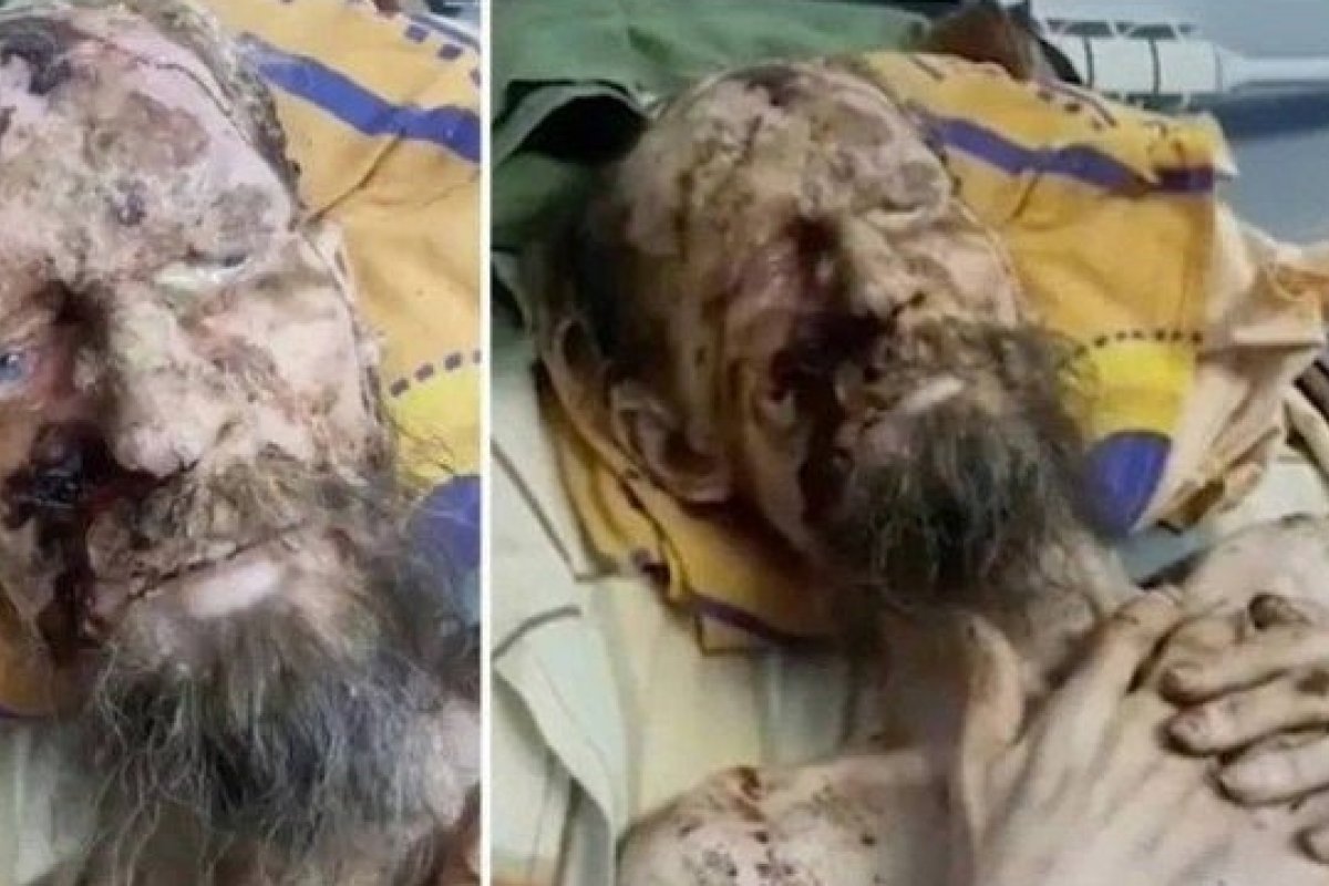[Homem 'múmia viva' é encontrado após um mês mantido 'refém' por urso]