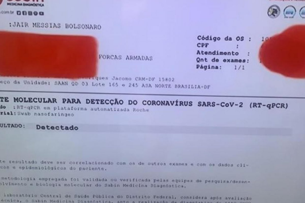 [Pela primeira vez, Bolsonaro usou nome verdadeiro em exame para covid-19]