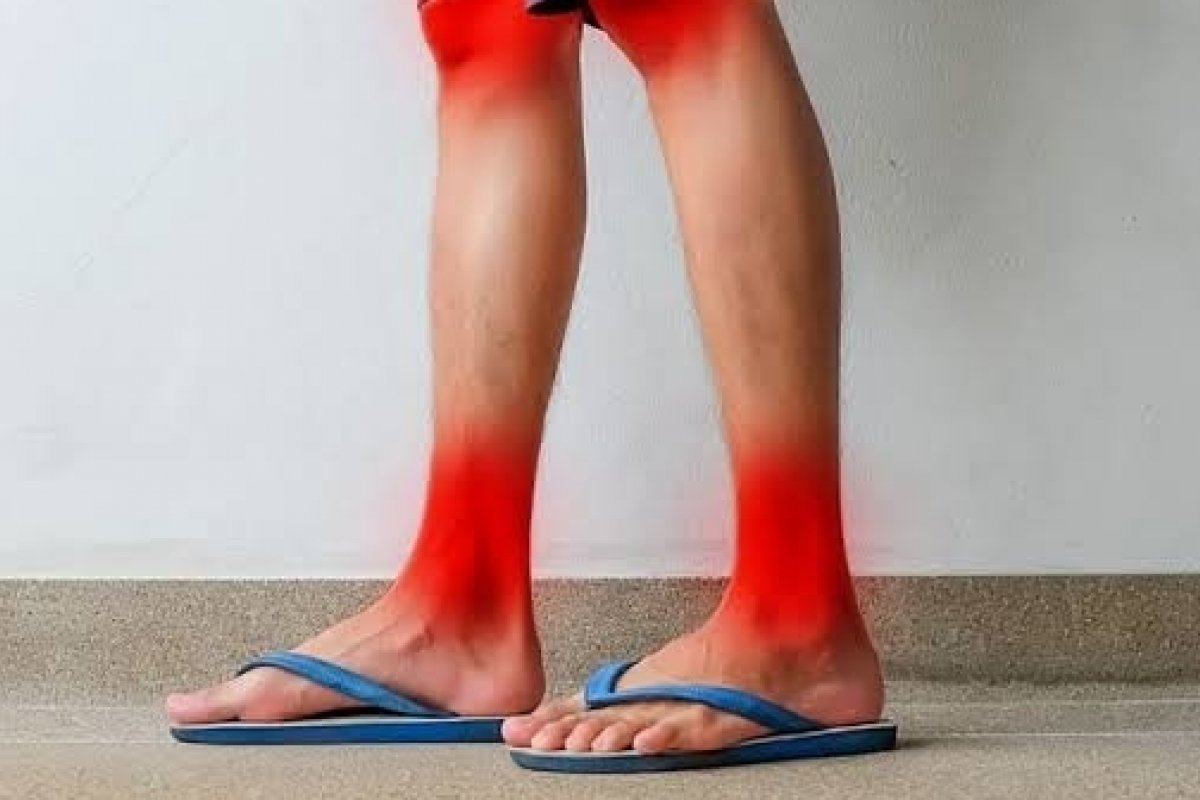 [Uso de chinelos por tempo prolongado pode levar a lesões nos pés]