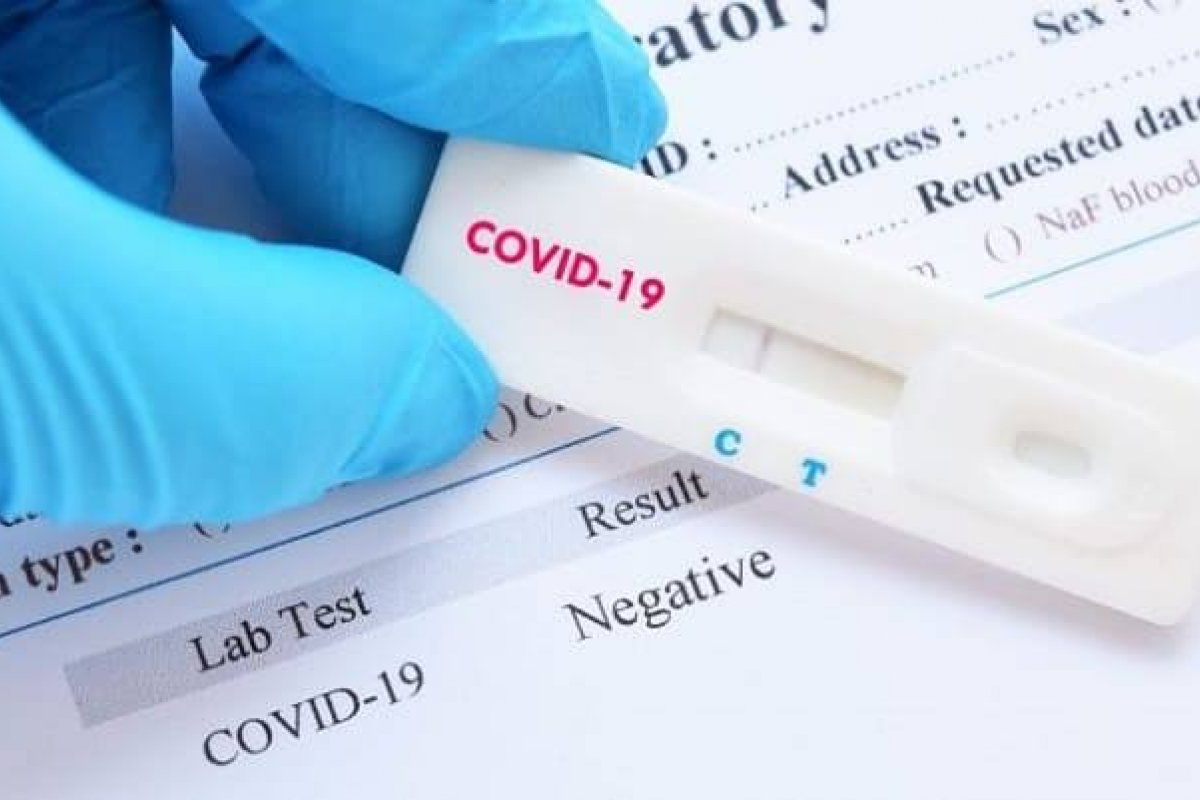 [A importância dos testes para reduzir a proliferação do coronavírus]